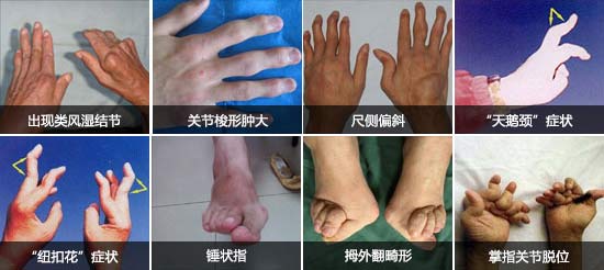 Fꖏ(qing)ֱt(y)ԺL(fng)ָ_ֺȶ̎P(gun)(ji).jpg