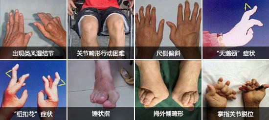 Fꖏ(qing)ֱt(y)ԺL(fng)P(gun)(ji)׿ָ_ֺȶ̎P(gun)(ji).jpg