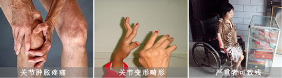F(yng)(qing)ֱt(y)ԺL(fng)(hu)(do)P(gun)(ji)[ʹΡ.jpg