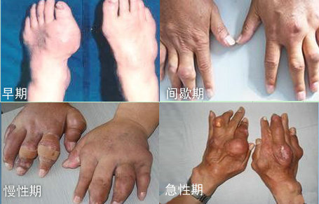 F(yng)(qing)ֱt(y)ԺʹL(fng)l(f)Ă(g)r(sh)ڰY.jpg