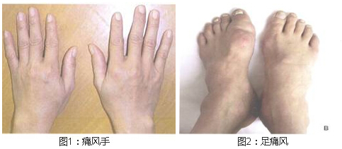 Fꖏ(qing)ֱt(y)ԺʹL(fng).jpg